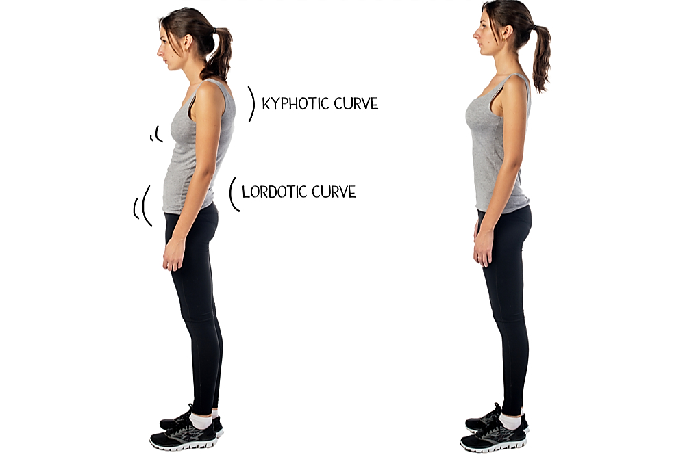 Postural Issues & Conditions