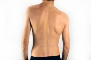Effective Yoga Techniques for Scoliosis Relief and Back Health