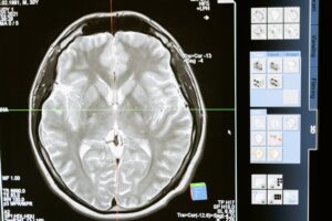 Brain scan analysis displaying detailed anatomical structure.