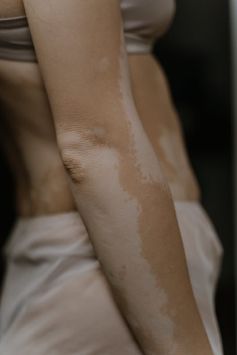 Detailed close-up of skin texture and patterns on an elbow.